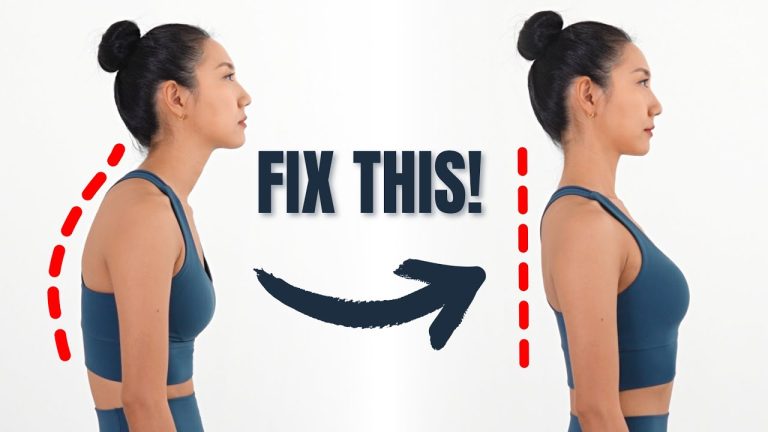 Correcting Crane Neck Posture for Better Health